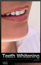 Teeth Whitening by Jean31
