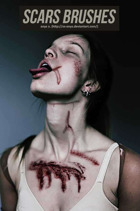 Brushes, Scars