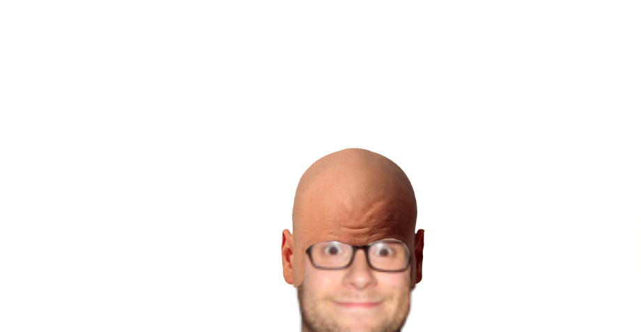 Seth Rogen With A Bald Head