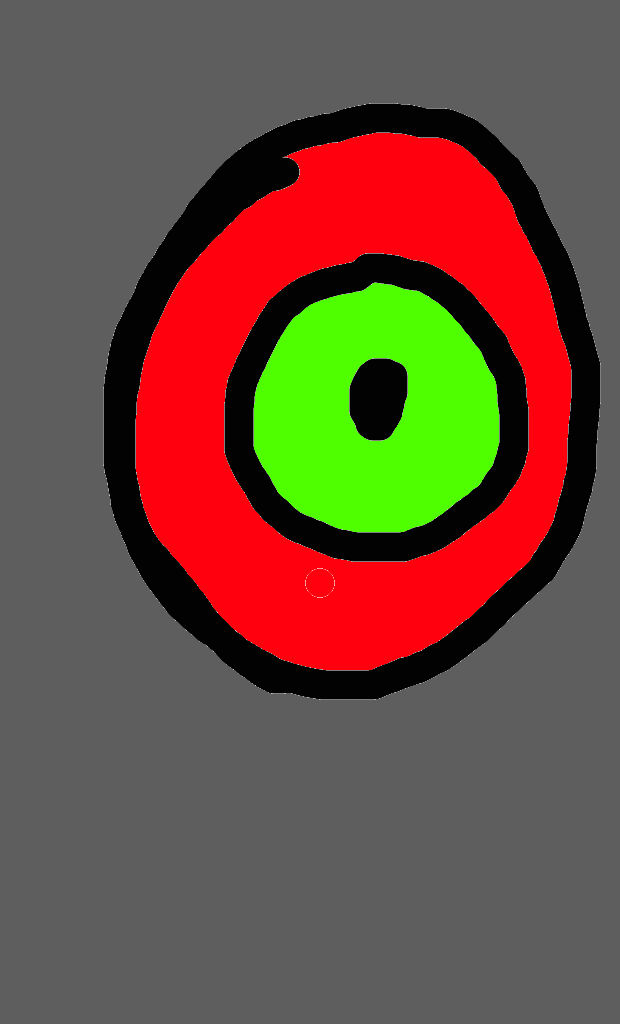 Zombie Eye by ThePurgatorian on DeviantArt