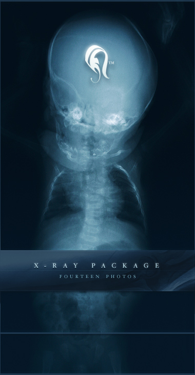 Package - X-ray - 1