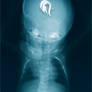 Package - X-ray - 1
