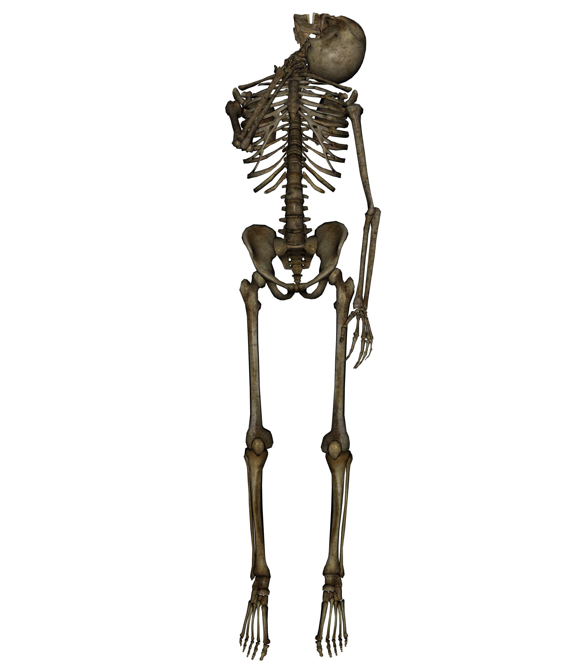 Skeleton - Hanged 2