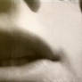 Epiglottis