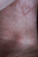 M E A T by Skullju1ce