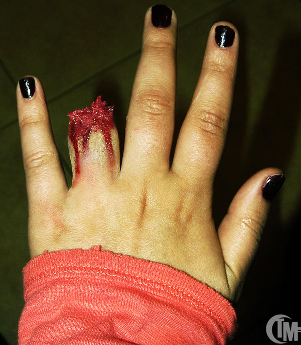cut fingers