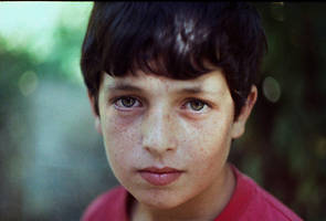 taches de rousseur by la-child