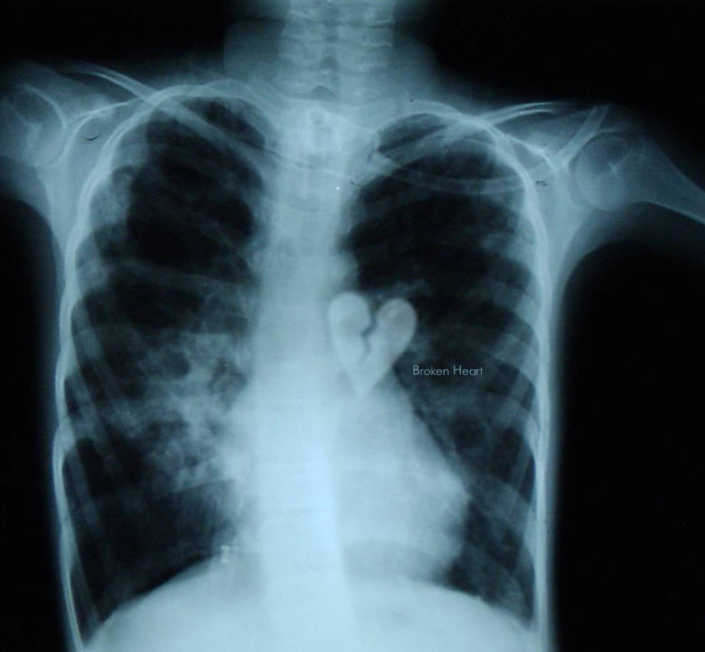 Broken Heart by sndr on DeviantArt