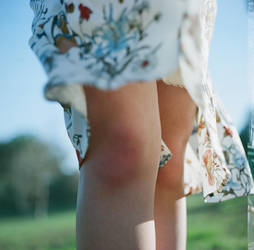 knees by LazloHollyfeld