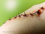 Stitches Close up by Guirnou