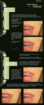Teeth Cleaning by FadedLine