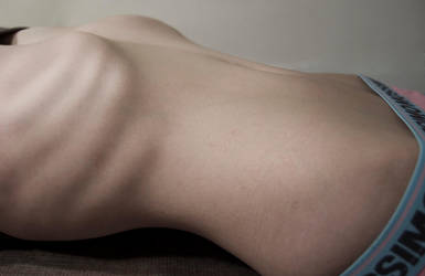 Dying to be Thin by Allabeth