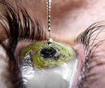 Eye Drop by AnthonyHearsey