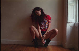 Cam Damage by Akemisatya