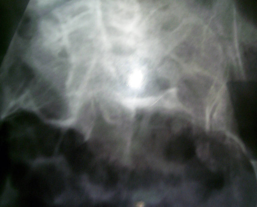 XRays by photoshop-stock