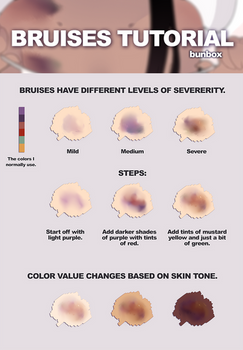 Bruises Tutorial by Bunsiebox