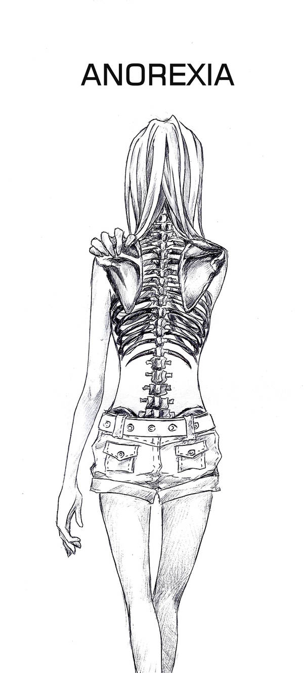 ANOREXIA by 3fukutaicho on DeviantArt