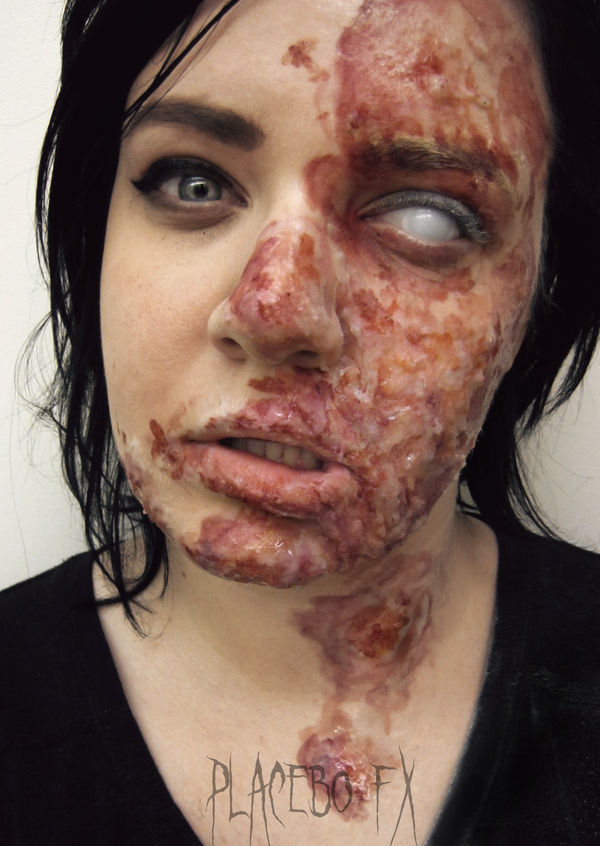 Chemical Burn by PlaceboFX