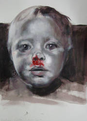 Bloody Nose - 01122011 by AEnigm4