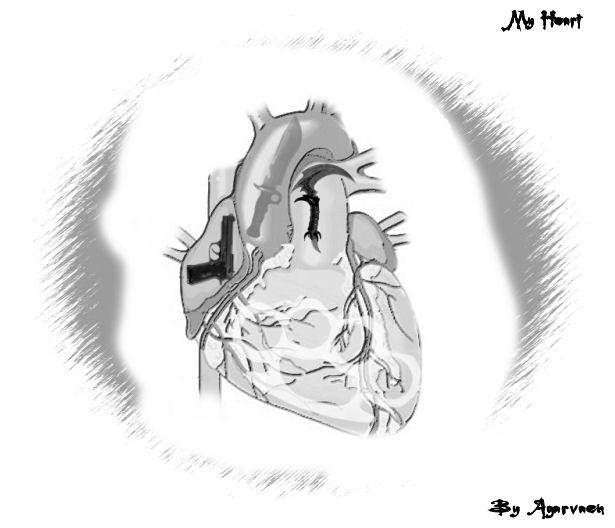 My heart