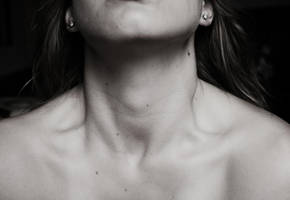 Alive by Insanityisthefuture