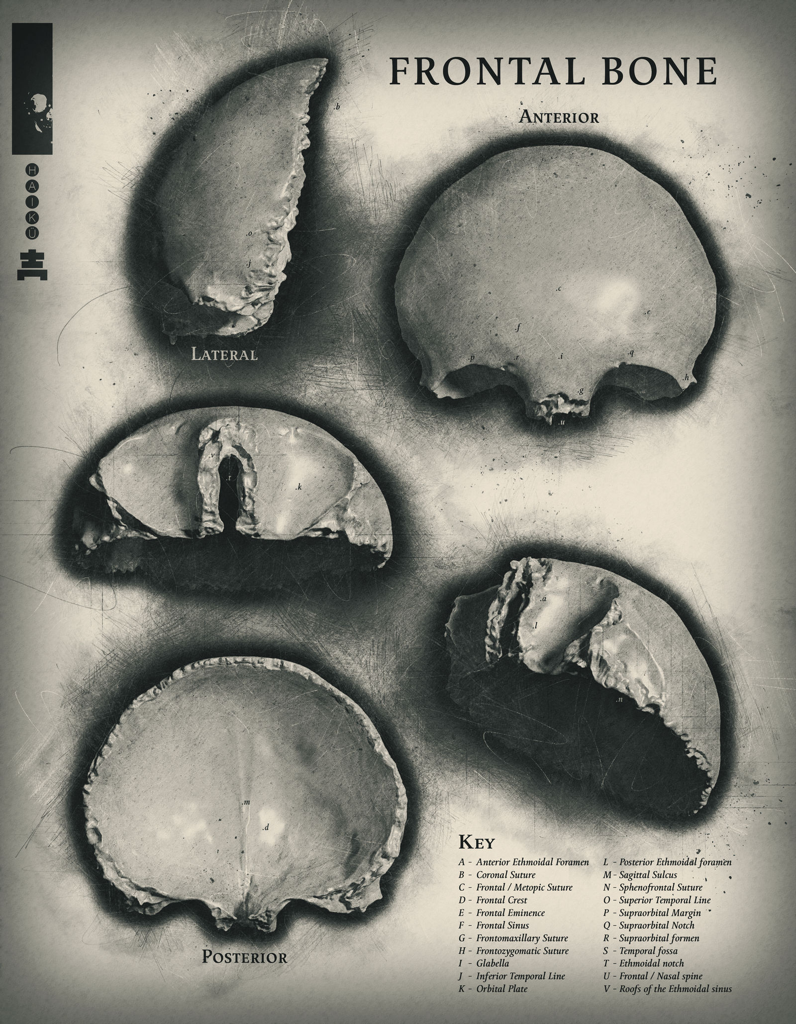 Frontal Bone Study by haikuo