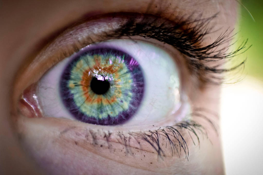 Yellow ring around the eye by MinervaAnne on DeviantArt