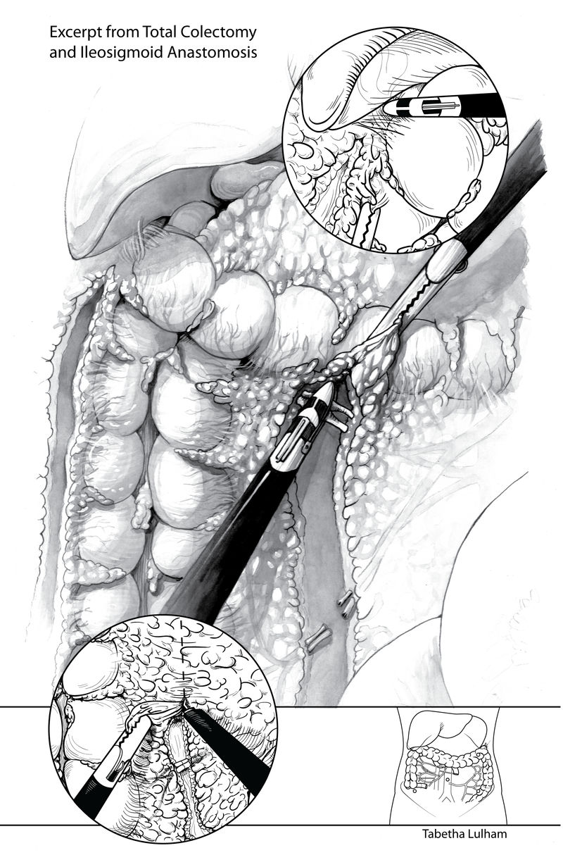 BMC - Surgical Illustration by Strayfish