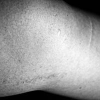 Scar by JKSmart-Photography