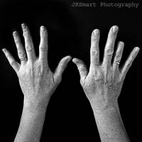 Scars III by JKSmart-Photography