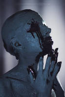 Retorridus Arteriae by Glenofobia