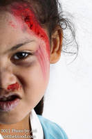 Zombie Anycia by NotTheBlood